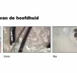 SiliBorstel Scalp Massager - Siliconen Haarborstel - Scalp Brush - Massage Borstel - Hoofdhuid Massage Borstels - Head Massager - Shampoo Borstel 7 SiliBorstel Scalp Massager - Siliconen Haarborstel - Scalp Brush - Massage Borstel - Hoofdhuid Massage Borstels - Head Massager - Shampoo Borstel -NIVEA Shop 550x234