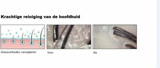 SiliBorstel Scalp Massager - Siliconen Haarborstel - Scalp Brush - Massage Borstel - Hoofdhuid Massage Borstels - Head Massager - Shampoo Borstel 3 SiliBorstel Scalp Massager - Siliconen Haarborstel - Scalp Brush - Massage Borstel - Hoofdhuid Massage Borstels - Head Massager - Shampoo Borstel - Afbeelding 3