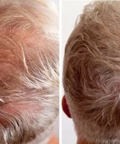 IMPERIO Premium Haarvezels Donkerbruin - Kaalheid Mannen - Alopecia Vrouwen - 100% Onzichtbaar -NIVEA Shop 550x363