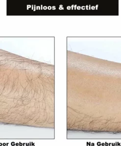 The Useful Crystal Hair Removal - Crystal Hair Eraser - Bleame - Kristalpad - Ontharing - Pijnloos - TikTok - Crystal Hair Remover - Haarverwijderaar -NIVEA Shop 550x495 2