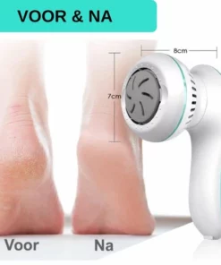 Forgoods Elektrische Eelt Verwijderaar Met Stofzuigsysteem En 6 Vijlschijven - Eeltverwijderaar - USB Oplaadbaar - Krachtigste Motor Op De Markt - Voetvijl - Inclusief Adapter 18W - Model 2022 -NIVEA Shop 550x533 2