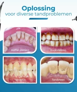 V-Goods Professionele Tandsteen Verwijderaar - 5 Standen - Inclusief Tandarts Set - Met 3 Opzetstukken - Elektrisch - Tandplak -NIVEA Shop 550x535