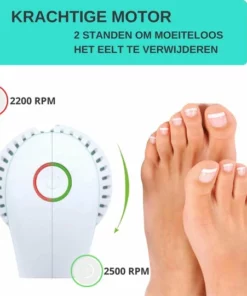 Forgoods Elektrische Eelt Verwijderaar Met Stofzuigsysteem En 6 Vijlschijven - Eeltverwijderaar - USB Oplaadbaar - Krachtigste Motor Op De Markt - Voetvijl - Inclusief Adapter 18W - Model 2022 -NIVEA Shop 550x540 1