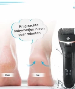 Merkloos Elektrische Eeltverwijderaar INCL. Mani En Pedicure Set - Voetvijl - Eeltvijl - Eelt Verwijderaar -Oplaadbaar -NIVEA Shop 550x547 28