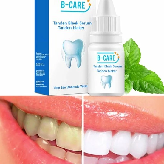 B-care Tanden Bleker – Wittere Tanden – Teeth Whitening Strips – Professioneel Resultaat - Tandsteen Verwijderaar - Zonder Peroxide - Tandenbleekset - Tanden Bleken - Black Friday – Sinterklaas – Schoencadeautjes Sinterklaas 2 B-care Tanden Bleker – Wittere Tanden – Teeth Whitening Strips – Professioneel Resultaat - Tandsteen Verwijderaar - Zonder Peroxide - Tandenbleekset - Tanden Bleken - Black Friday – Sinterklaas – Schoencadeautjes Sinterklaas - Afbeelding 2