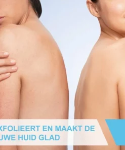 CeraVe - SA Smoothing Cream - Bodycréme - Droge En Ruwe Huid - 340 G -NIVEA Shop 550x550 1503