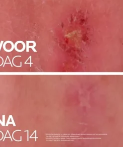 La Roche-Posay Dagcrème Cicaplast Balsem B5+ - 100 Ml -NIVEA Shop 550x550 1557