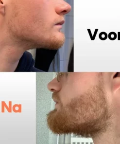 Finez Baardgroei Kit Navulverpakking – Baardolie Met Baardroller – Baardverzorging Set 2 Delig - Baardgroei -NIVEA Shop 550x550 1635