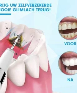 DEN-T® PRO U500 - Elektrische Sonische Tandsteen Verwijderaar - Wit -NIVEA Shop 550x550 1784
