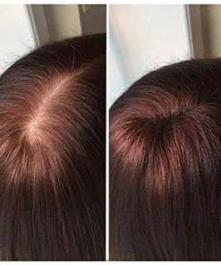 IMPERIO Premium Haarvezels Donkerbruin - Kaalheid Mannen - Alopecia Vrouwen - 100% Onzichtbaar -NIVEA Shop 550x550 193