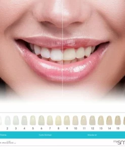 My Smile MySmile Tandenbleekset - Thuis Tanden Bleken - Met Natuurlijke Ingrediënten -NIVEA Shop 550x550 995