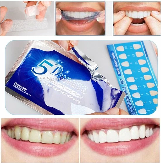 5D White Whitening Strips | Tanden Bleken Strips | Tanden Bleken | Tanden Strips | Wit Gebit | Witte Tanden | Tandenblekers | Tandenbleekset | Tandenbleek Strips | Geen Crest | Crest Whitestrips | Wittere Tanden 4 5D White Whitening Strips | Tanden Bleken Strips | Tanden Bleken | Tanden Strips | Wit Gebit | Witte Tanden | Tandenblekers | Tandenbleekset | Tandenbleek Strips | Geen Crest | Crest Whitestrips | Wittere Tanden - Afbeelding 4