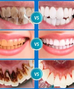 B-care Tanden Bleker – Wittere Tanden – Teeth Whitening Strips – Professioneel Resultaat - Tandsteen Verwijderaar - Zonder Peroxide - Tandenbleekset - Tanden Bleken - Black Friday – Sinterklaas – Schoencadeautjes Sinterklaas 18 B-care Tanden Bleker – Wittere Tanden – Teeth Whitening Strips – Professioneel Resultaat - Tandsteen Verwijderaar - Zonder Peroxide - Tandenbleekset - Tanden Bleken - Black Friday – Sinterklaas – Schoencadeautjes Sinterklaas -NIVEA Shop 550x558 11