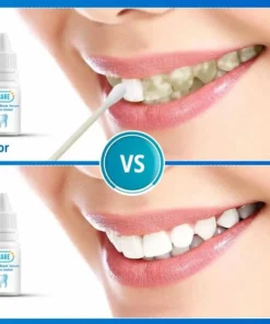 B-care Tanden Bleker – Wittere Tanden – Teeth Whitening Strips – Professioneel Resultaat - Tandsteen Verwijderaar - Zonder Peroxide - Tandenbleekset - Tanden Bleken - Black Friday – Sinterklaas – Schoencadeautjes Sinterklaas 19 B-care Tanden Bleker – Wittere Tanden – Teeth Whitening Strips – Professioneel Resultaat - Tandsteen Verwijderaar - Zonder Peroxide - Tandenbleekset - Tanden Bleken - Black Friday – Sinterklaas – Schoencadeautjes Sinterklaas -NIVEA Shop 550x560 4