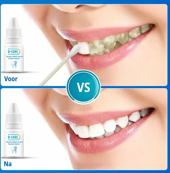 B-care Tanden Bleker – Wittere Tanden – Teeth Whitening Strips – Professioneel Resultaat - Tandsteen Verwijderaar - Zonder Peroxide - Tandenbleekset - Tanden Bleken - Black Friday – Sinterklaas – Schoencadeautjes Sinterklaas 8 B-care Tanden Bleker – Wittere Tanden – Teeth Whitening Strips – Professioneel Resultaat - Tandsteen Verwijderaar - Zonder Peroxide - Tandenbleekset - Tanden Bleken - Black Friday – Sinterklaas – Schoencadeautjes Sinterklaas - Afbeelding 8
